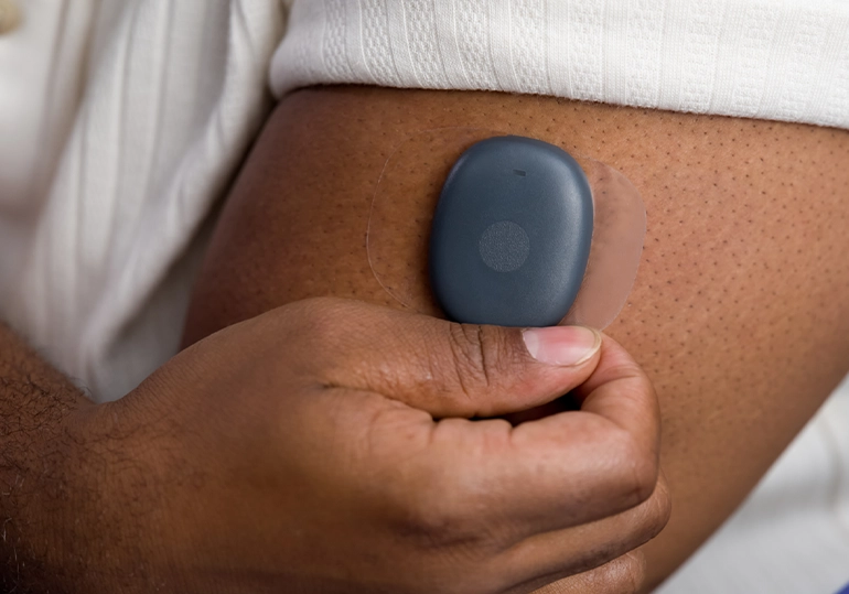 Eversense 365 Continuous Glucose Monitoring Andalusia Alabama